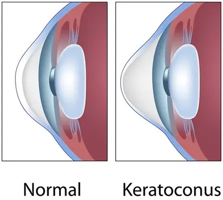 Eye Illustration